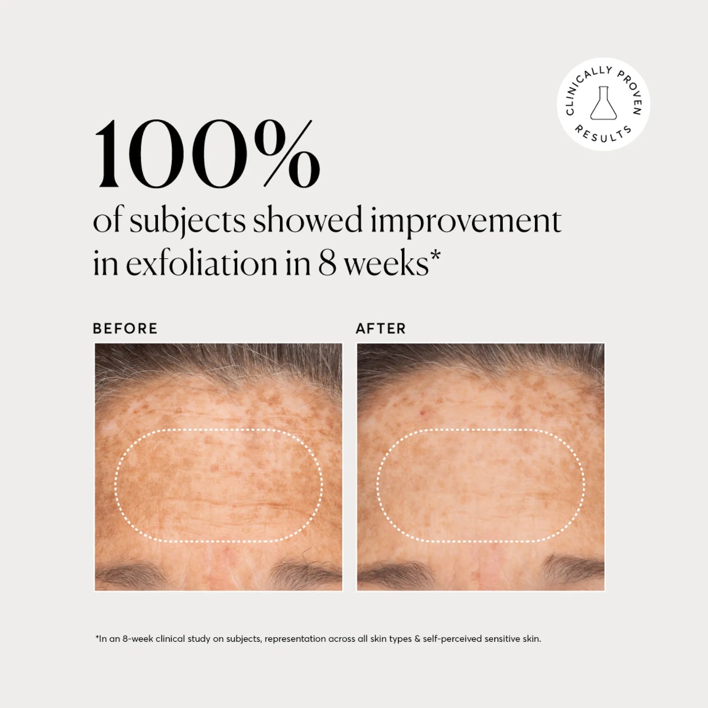 bha-liquid-exfoliant-2-s0 NATR-10027-Alt-Images-BHA-Liquid-Exfoliant-2_-03.webp